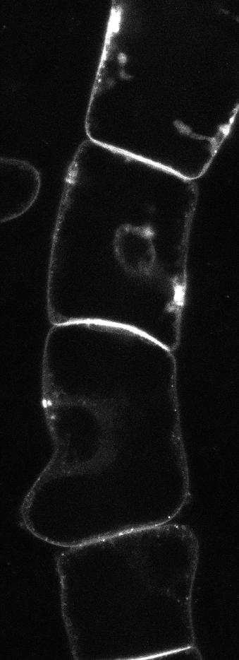 PGP4-GFP