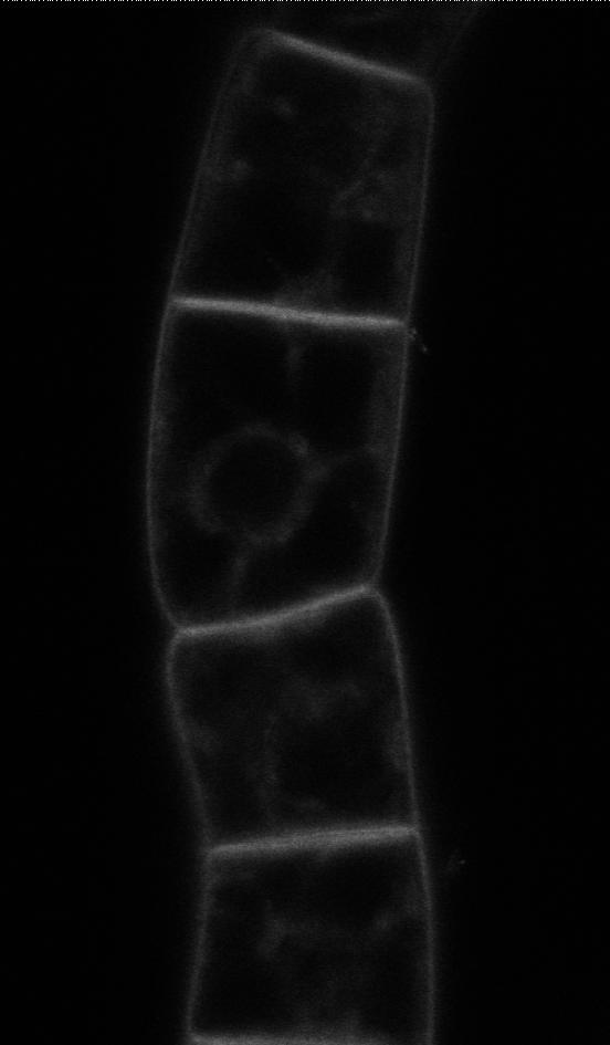 membrane