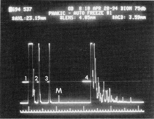 Obr.č.8 Gates jsou elektronická měřidla na displeji, kdy mezi každým párem provádí měření.
