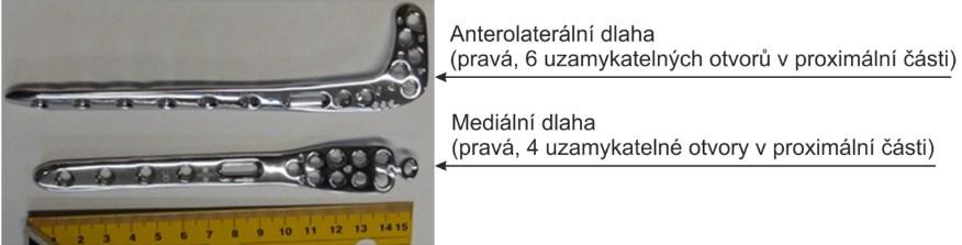 6 METODIKA TESTOVÁNÍ DLAH Pro stanovení pevnosti a spolehlivosti dlah byly navrhnuty následující experimenty, které zkoumají chování implantátů s částečně zhojenou kostní tkání (vytvořeným svalkem) a