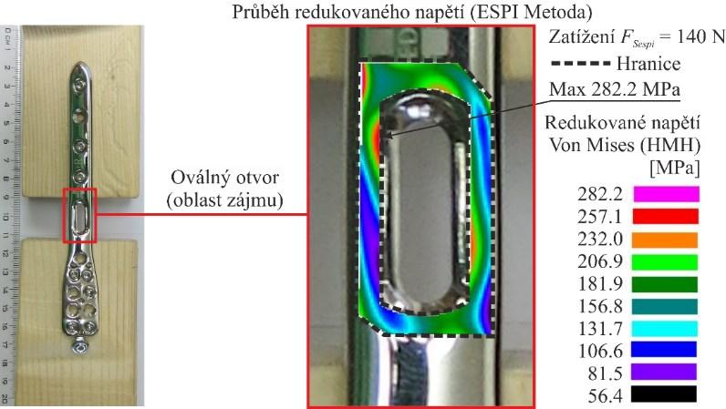 U vzorků č. 2-4 bylo stanoveno, do jaké míry dojde k rozložení celkové síly mezi dlahu a kost, v případě kdy kost byla nahrazena tenzometrickým snímačem síly. U vzorku č.