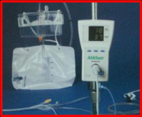 IAH/ACS 2011/2012 definice monitorace rizikové skupiny 1. traumatologičtí pacienti s velkými krevními ztrátami 2.