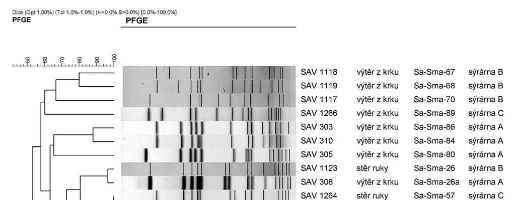 Výsledky studie nepotvrdily klonální shodu mezi kmeny S.