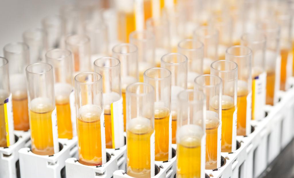 Evropská komise Informační přehled pro výrobce diagnostických zdravotnických prostředků in vitro Tento informační přehled je určen pro výrobce diagnostických zdravotnických prostředků in vitro.