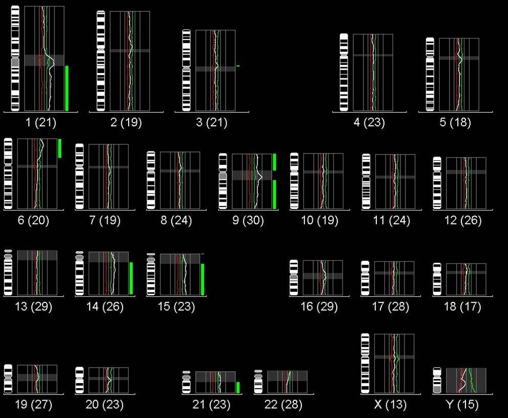 Tabulka 13: Ztráta chromosomu Y u muţů zjištěná metodou FICTION Číslo pacienta Myelomové buňky XY (%) X0 (%) Ostatní buňky XY (%) XO (%) 8