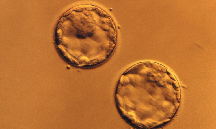 Kryokonzervace embryí a jejich dlouhodobé uchovávání Kryokonzervace je proces šetrného zmražení embryí.