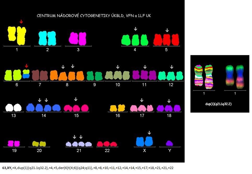 Obrázek 8: Příklad vyšetření metodou mfish a doplněný mband chromozomu 1.