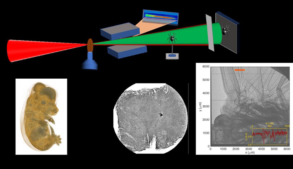 2.5. Applications of betatron and Compton radiation Figure 2.8: (a) Schematic drawing of experiment for propagation-based x-ray phase contrast microtomography.