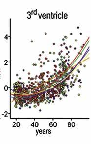 Kvadratická závislost objemu mozkové struktury na věku y = β 0 + β 1 x + β 2 x 2 + ε y X β ε 1.5 2.6-0.8.