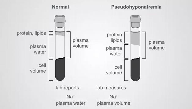 pseudohypernatremia neexistuje, ale u těžké hypoalb se mohou