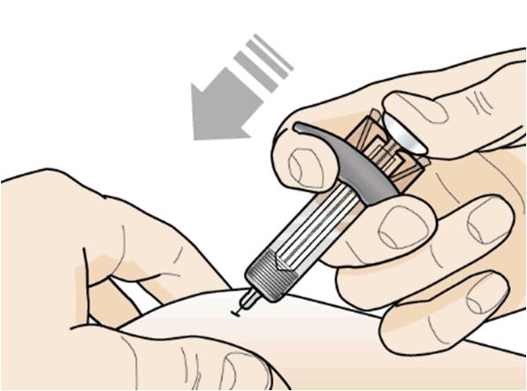 Jemně přidržte na kůži vatový tampón nebo gázu, dokud se krvácení nezastaví. Místo vpichu netřete. V případě potřeby zalepte místo vpichu náplastí.