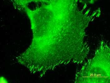 Bacakova) stainin g of talin - patent pending on selective growth of living cells