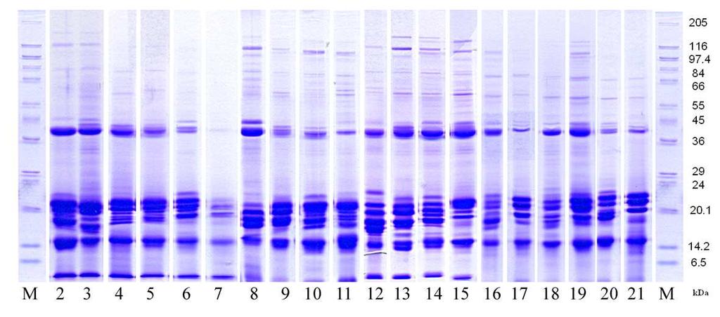 5.1.2. Zhodnocení variability bílkovinných profilů hlíz programem BIO 1D++ (BioProfil) Výsledek elektroforetické separace pomocí SDS PAGE u zvolených odrůd znázorňuje (Obr.3).