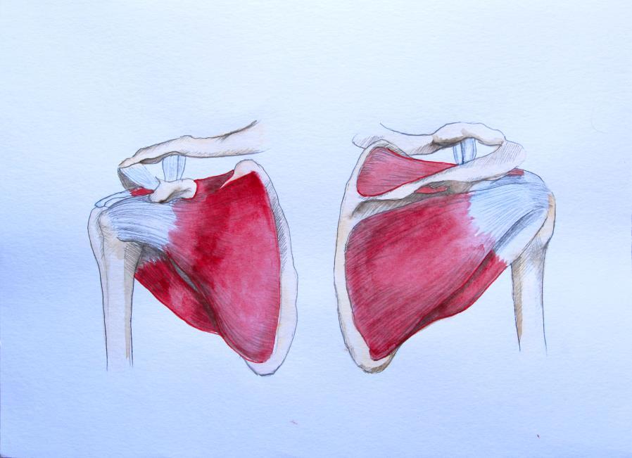 Léčba - klidový režim - nesteroidní antirevmatika 4.5.3.5 Tendinitis m. subscapularis, m.supraspinatus, m. infraspinatus, m.