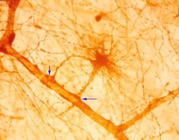 Centrální glie - astrocyty největší, paprsčitý vzhled, dlouhé výběžky, perivaskulární nožky, gliofilamenta