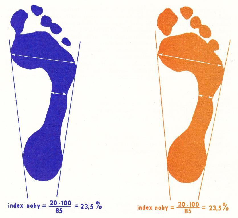 třídy základní školy, jejichž tělesné parametry byly sledovány pomocí pěti opakovaných měření (Bláha, Vignerová, Paulová, Riedlová, Kobzová a Krejčovský, 199