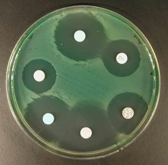disky). Antibiotika difundují agarem. Je-li kmen citlivý, vytvoří se zóna citlivosti.