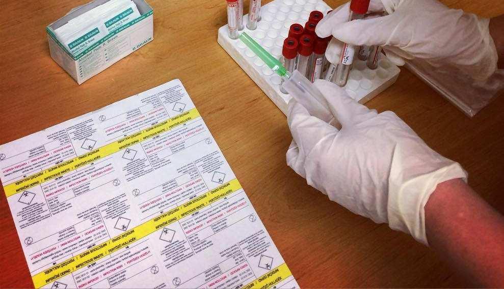 Testování na infekční nemoci 25 testovaných Cílem služby je zjištění možnosti výskytu infekčního onemocnění u klientů.