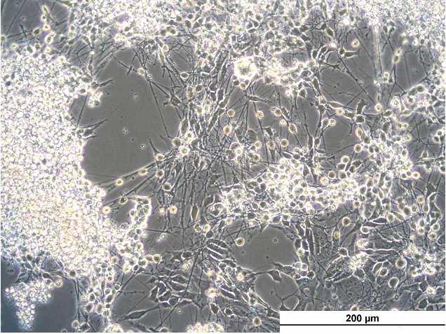 Imunocytochemické stanovení Oct-3/4