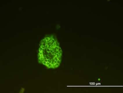 Obrázek 7 Imunocytochemické stanovení