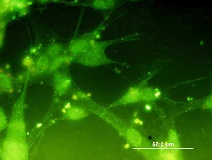 Obrázek 10 Imunocytochemické stanovení