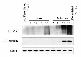 Obrázek 12 Western blot nediferencovaných a diferencovaných ES D3 buněk 7.