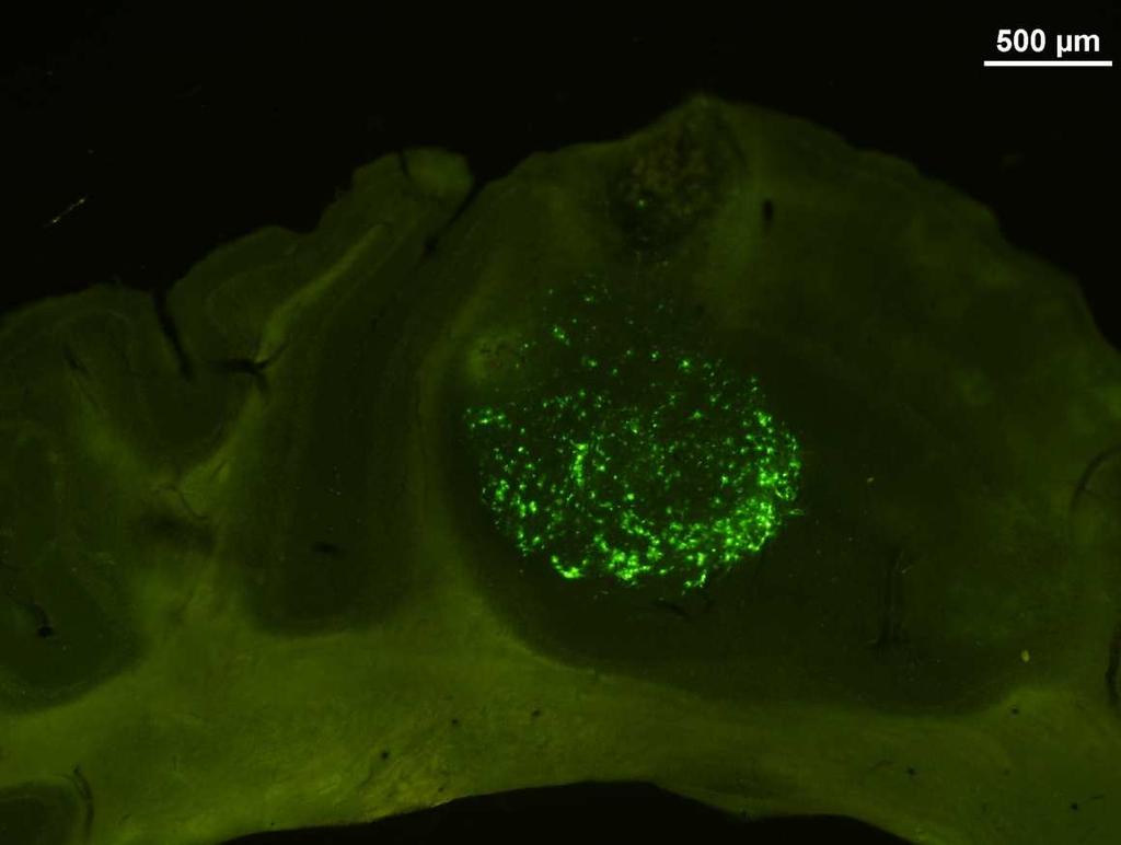 Obrázek 13 GFP pozitivní buňky na řezu mozečku WT myši po transplantaci neuroprogenitorů Přežití transplantovaných buněk U myší shodného typu, tedy u myší WT či Lc, 3 týdny po aplikaci nebyl v