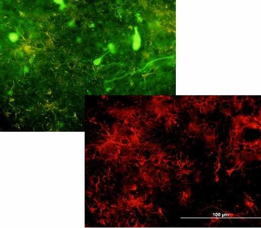 Obrázek 29 Transplantované GFP