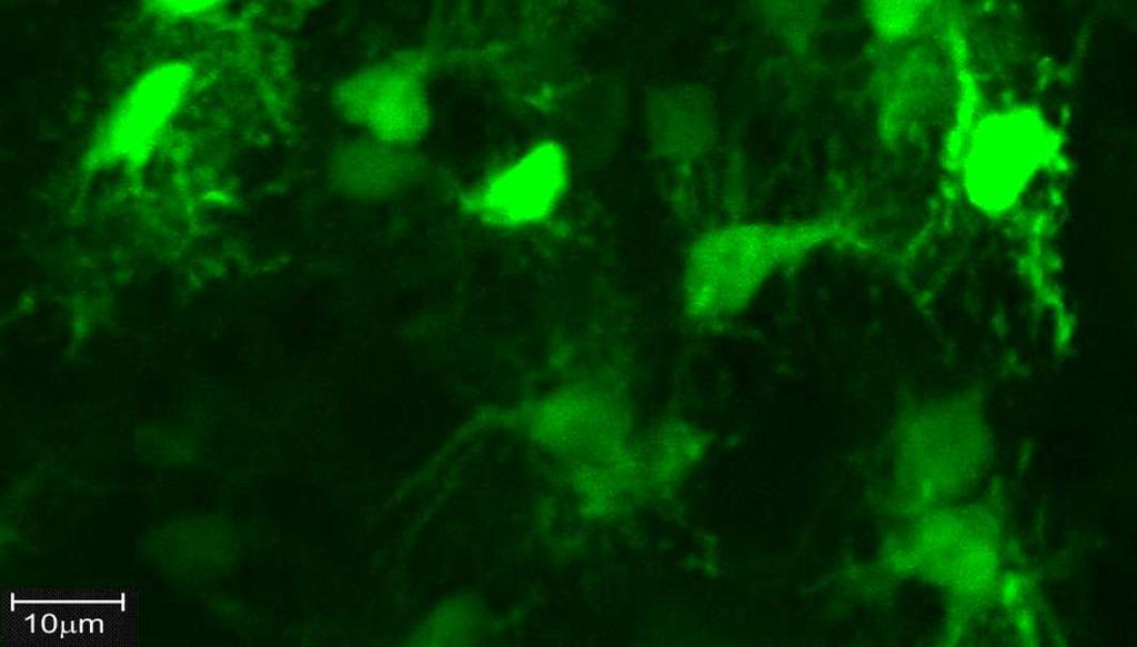 Obrázek 31 GFP pozitivní buňky nalezené při histologickém vyšetření transplantátu, u nichž je jasně viditelný neuronální charakter, včetně nervových výběžků Při porovnání lokalizace, se transplantát