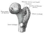 A1- TROCHANTER MAJOR terapie