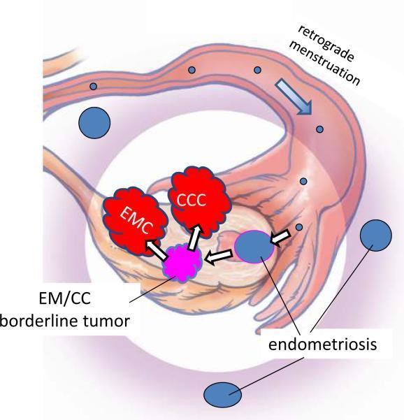 Etiopatogeneze ovariálního karcinomu (4) V posledních pěti až šesti letech se událo na poli pochopení patogeneze epiteliálního ovariálního karcinomu mnohé.