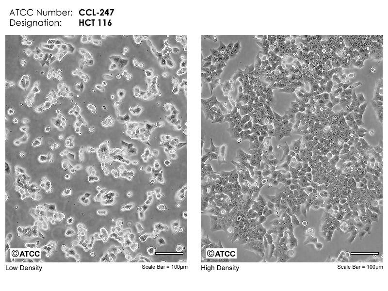 Protokol 2 Detekce ROS, buněčného cyklu a buněčné životnosti po ovlivnění buněk HCT-116 inhibitorem neddylace Cíle - cílem experimentu 1 je ovlivnit buněčnou linii HCT-116 inhibitorem neddylace