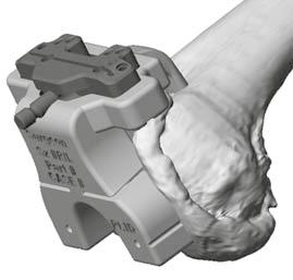 Guides are designed to provide accurate