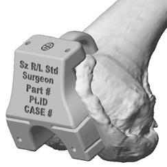 by surgeon preferences and reflected in the