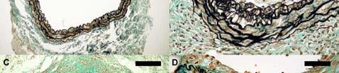 adjacent host aorta segments.