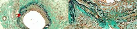 abdominal aorta of a wild-type mouse
