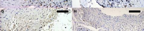 transplantation case (group 3) with