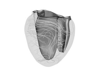 Simulations in Biomedicine 33 Figure 3: Geometry of the dog heart with outlined network of muscle fibres. Figure 4: Propagation of the action potential.