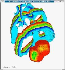 Figure 6: Stress distribution in active (muscle) fibres. respectively. Difference between contracted and released heart geometry is demonstrated in Fig. 5.
