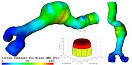 The global stiffness matrix covered the system of relations among all the nodal movements represented by vector c and appropriate components of nodal reactions forces.