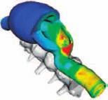 The results of this study support the clinical observation that the danger of aneurysm rupture is highest in the dorsal or dorsolateral wall of the aneurysmatic sac.