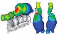 tensile wall stress, shear stress, flow patterns such as recirculation, and blood pressure.
