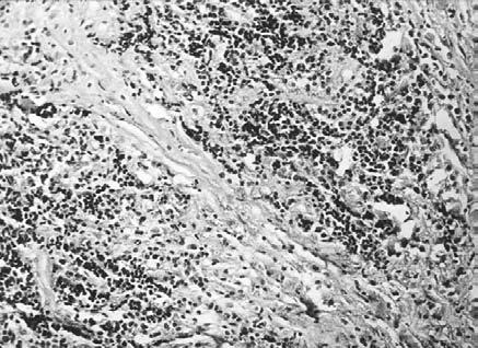 fine connective tissue with fibroblasts, collagen (mostly Type III), and smooth muscle cells (SMC).