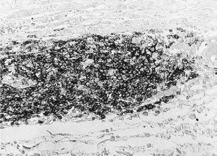 94 N V Treska, J Kocova, L Boudova et al. The control group of abdominal aortas had significantly lower cytosol concentrations of IL-1b (p B/ 0.0001), IL-6 (p B/0.0001), IL-8 (p B/0.