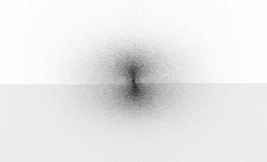 The second program used the image of the Fourier spectra as an input image and applied the methods for recognition of the degree of elastinolysis.