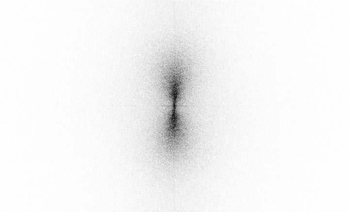 was repressed beneath the atherosclerotic plaque. In the atherosclerotic aortae, we observed a smoothing and straightening of the elastin membranes (Fig. 3).