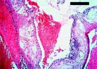 1 2 5 6 Figure 1 Mouse cardiac allografts of apo E KO and wild-type mice 1 month after transplantation.