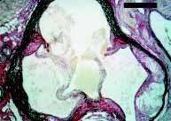 DISCUSSION We have demonstrated that total cholesterolemia as well as VLDL, IDL and LDL fractions of apo E KO mice on chow diet