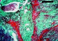 (10,11) Whilst the composition of VLDL of wild-type mice was similar to that seen in humans, and equivalent to the