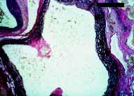 5 as a result of cholesterol accumulation in VLDL particles. The HDL levels of apo E KO mice were lower compared to wildtype mice.